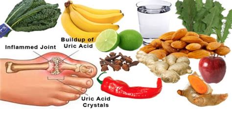 uri food plan|Diet For High Uric Acid: How To Lower Your Uric Acid Levels .